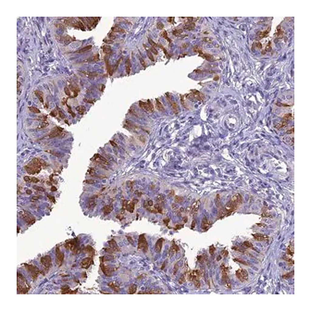 Merck Anti-BBS2 antibody produced in rabbit