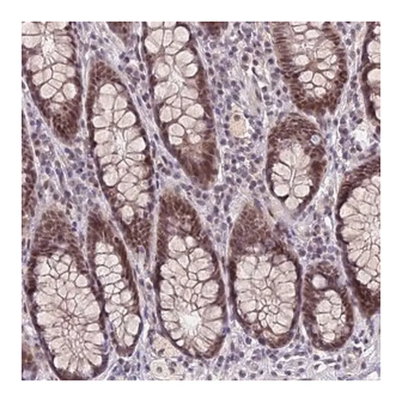 Merck Anti-NSMCE1 antibody produced in rabbit