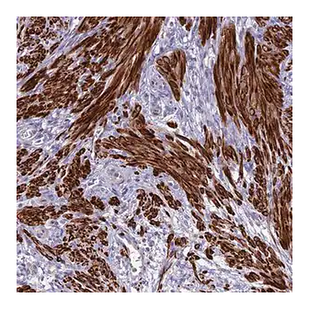 Merck Anti-CLIP4 antibody produced in rabbit