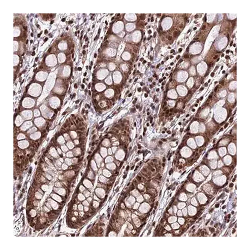 Merck Anti-CIB3 antibody produced in rabbit
