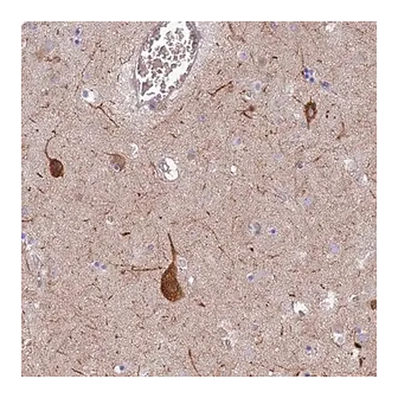 Merck Anti-RHBDL2 antibody produced in rabbit