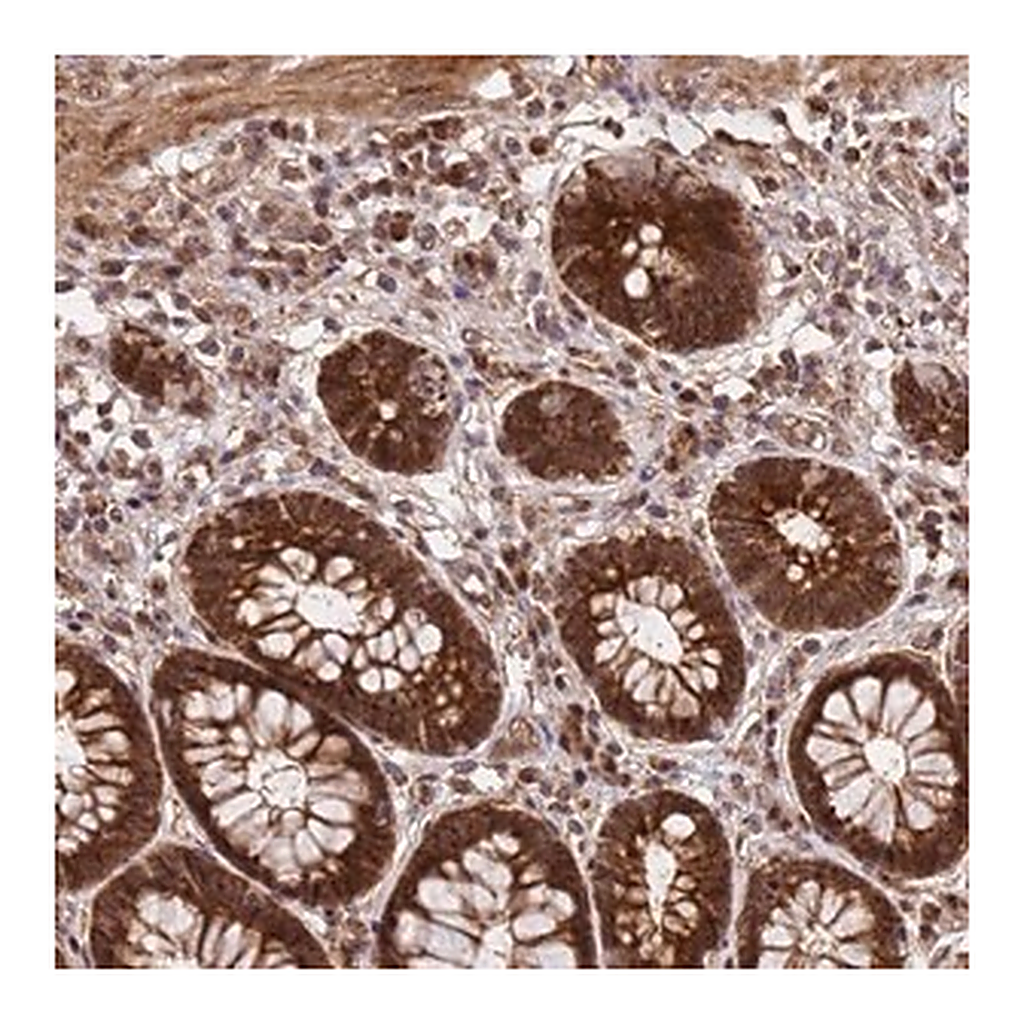 Merck Anti-GPATCH8 antibody produced in rabbit