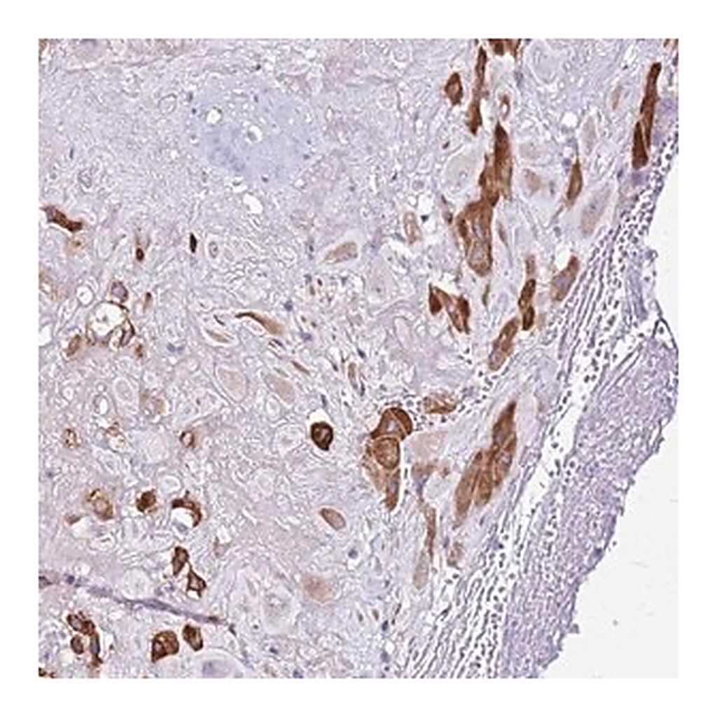 Merck Anti-CASD1 antibody produced in rabbit