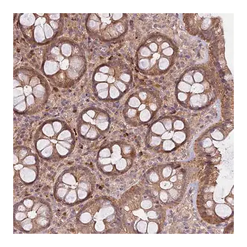 Merck Anti-METTL13 antibody produced in rabbit