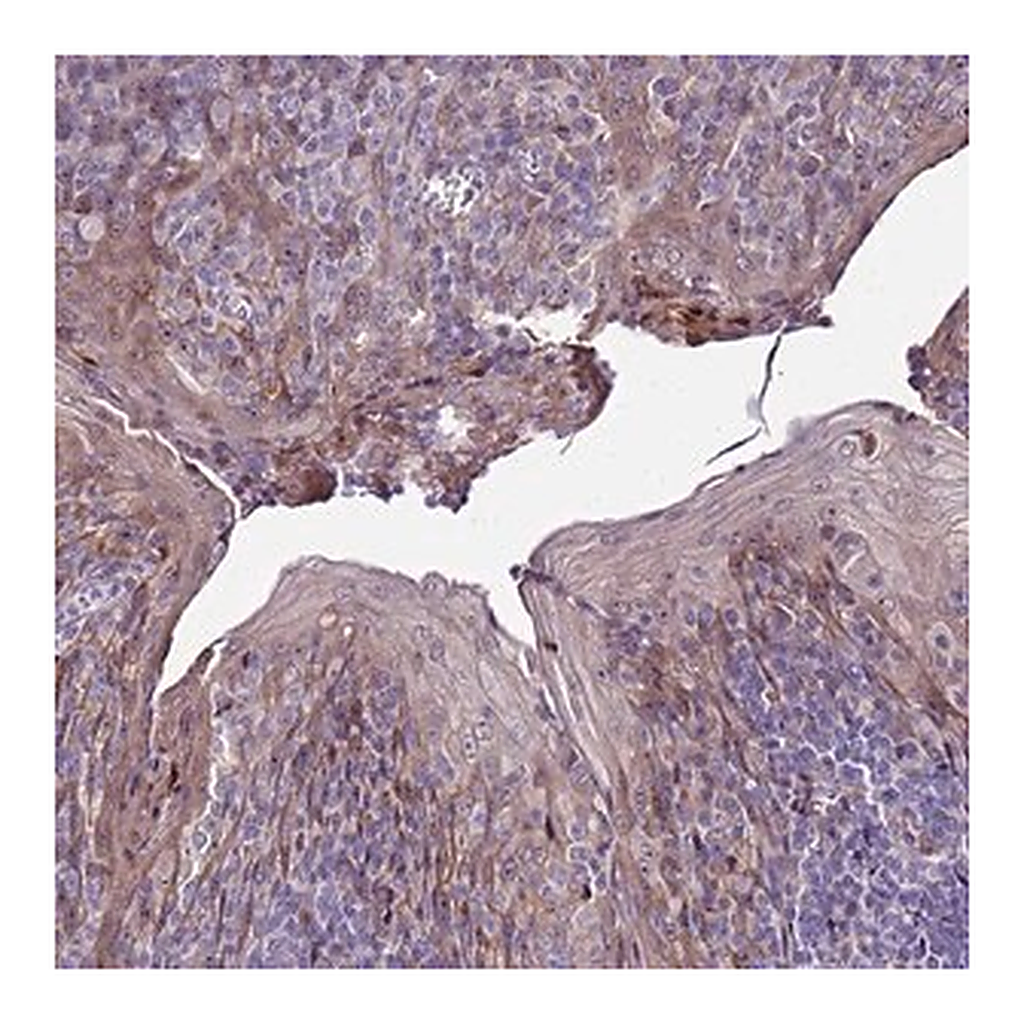 Merck Anti-NOL8 antibody produced in rabbit