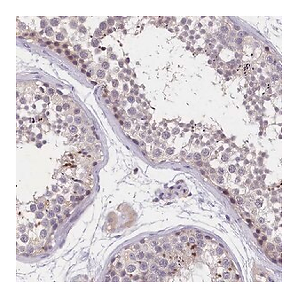 Merck Anti-ST7L antibody produced in rabbit