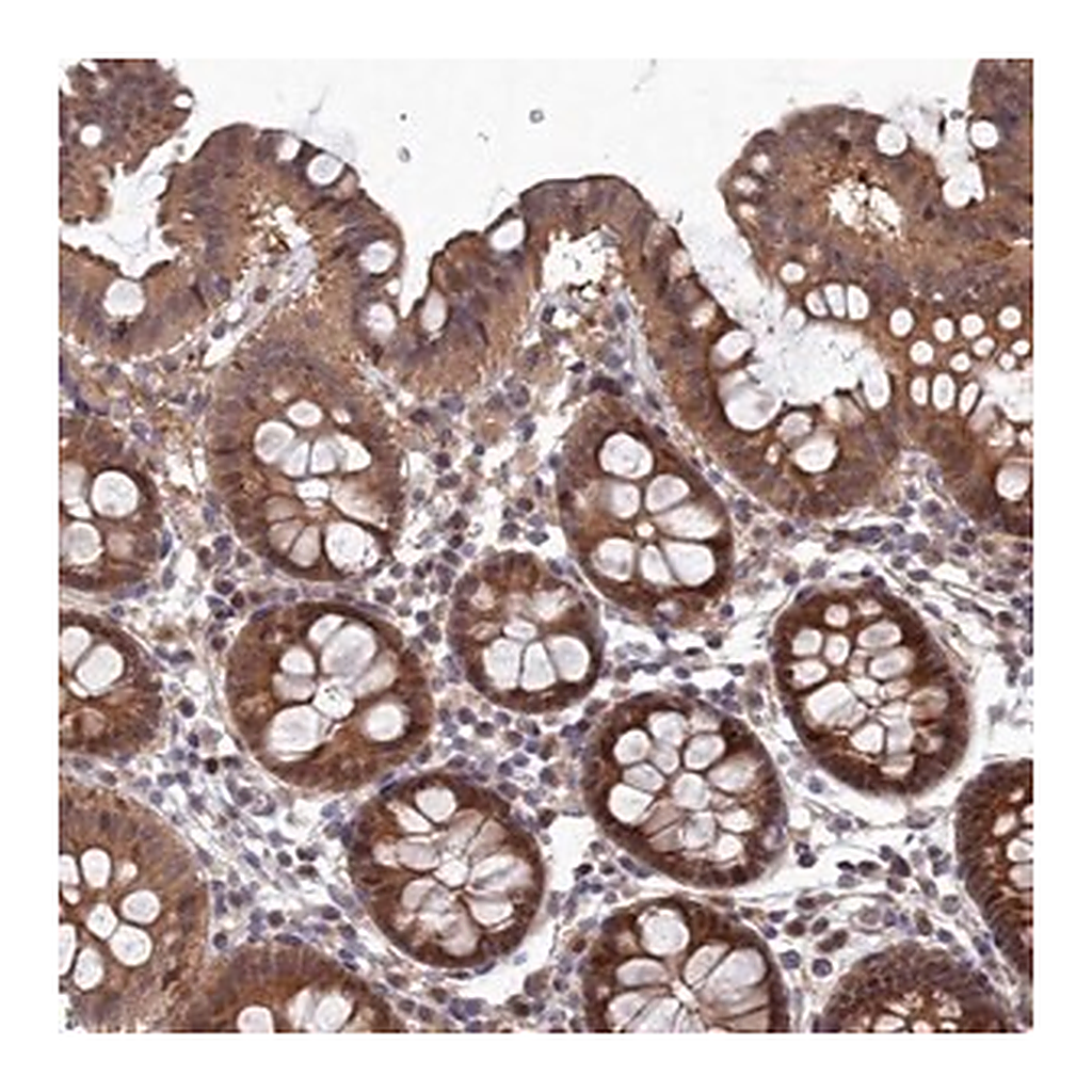 Merck Anti-ELOVL6 antibody produced in rabbit