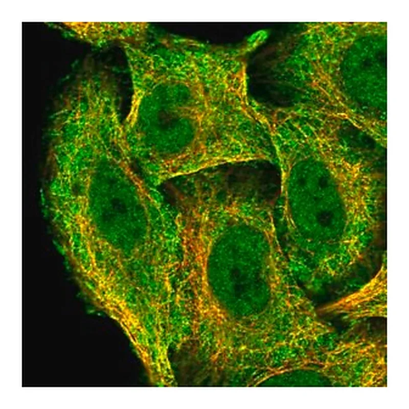 Merck Anti-ZNF646 antibody produced in rabbit