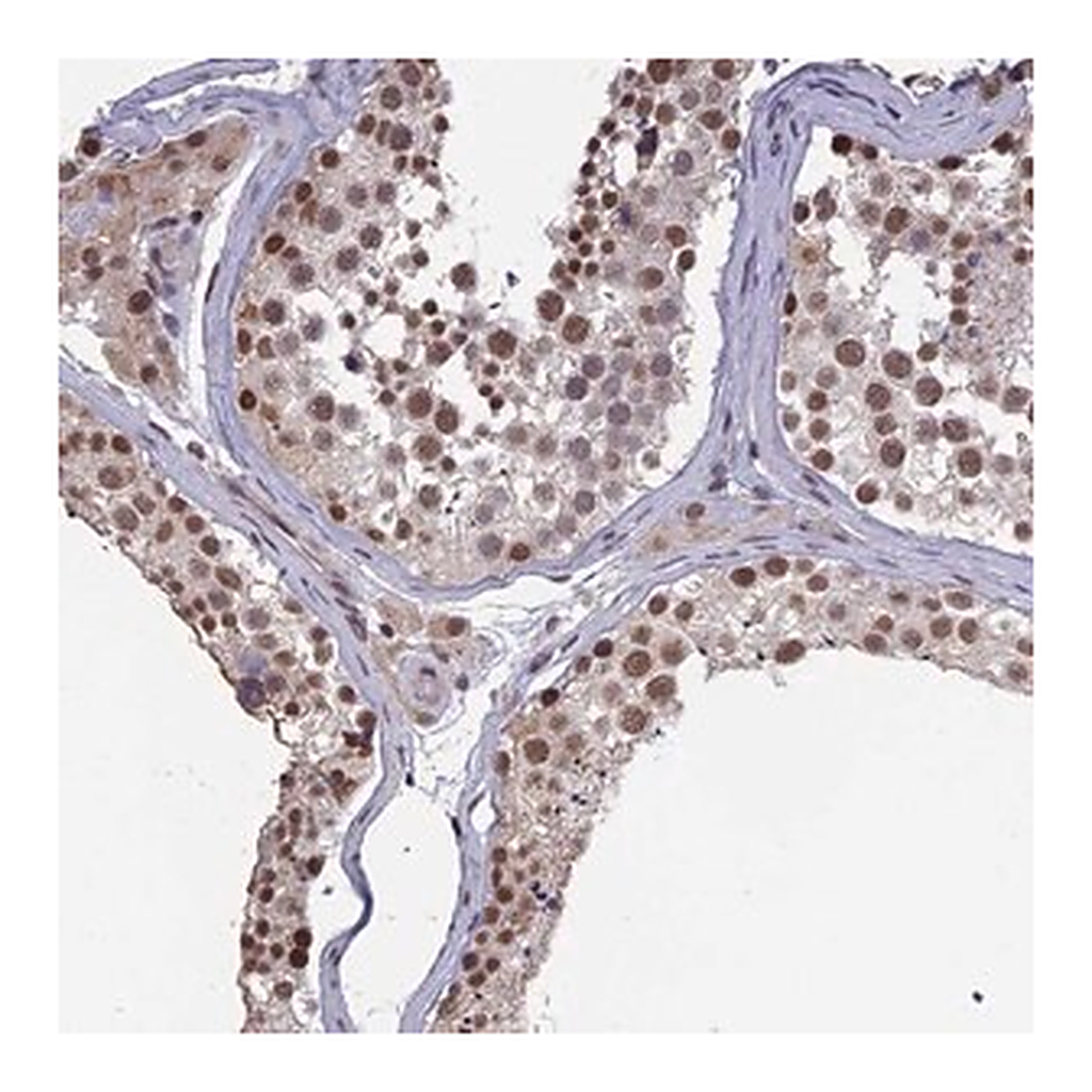 Merck Anti-MORF4L1 antibody produced in rabbit