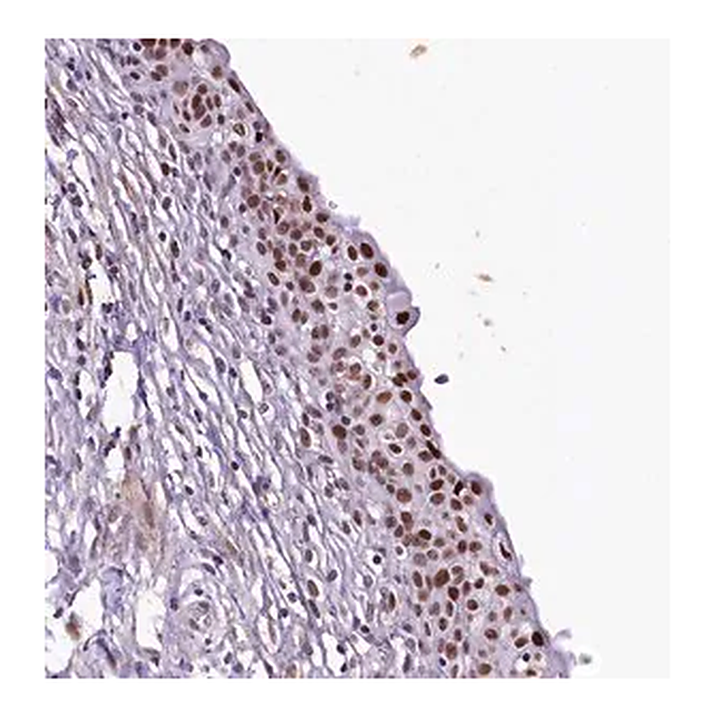 Merck Anti-SAMD10 antibody produced in rabbit