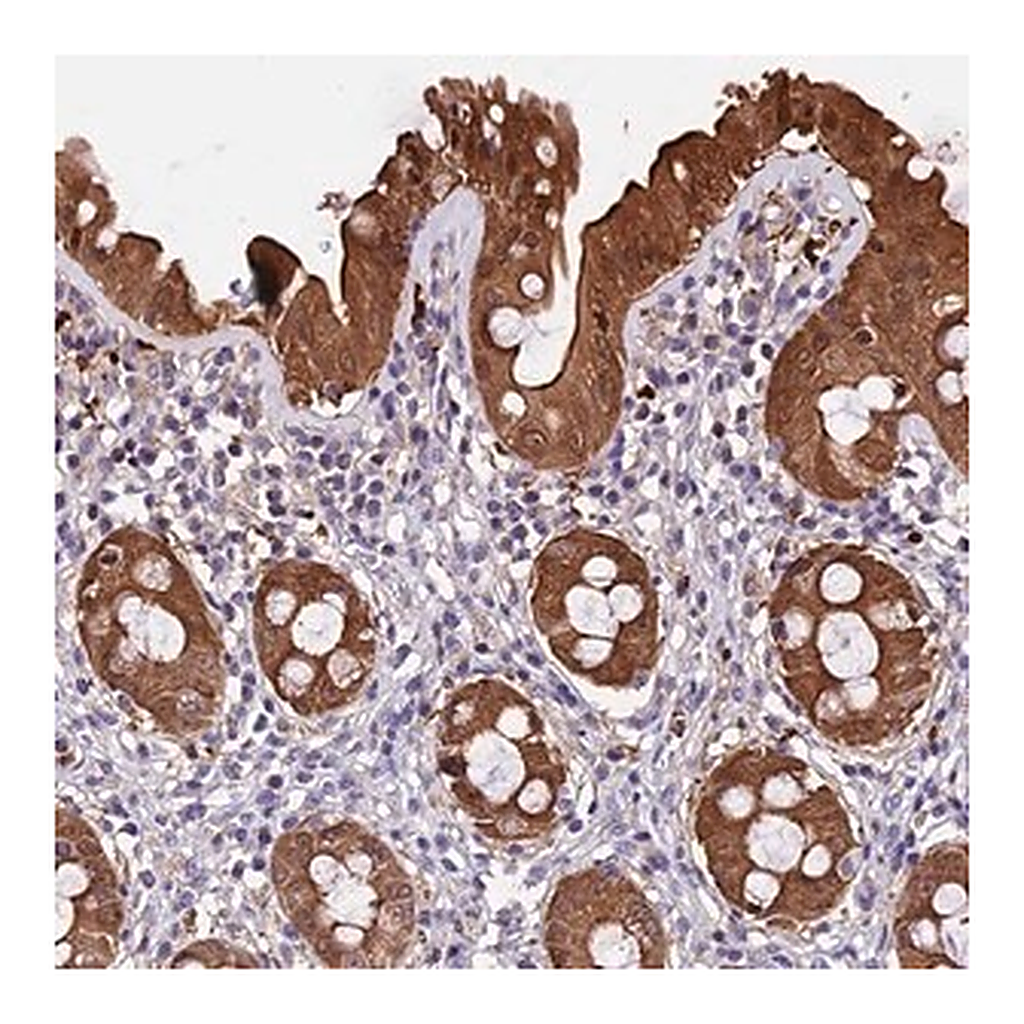 Merck Anti-MAP3K7CL antibody produced in rabbit