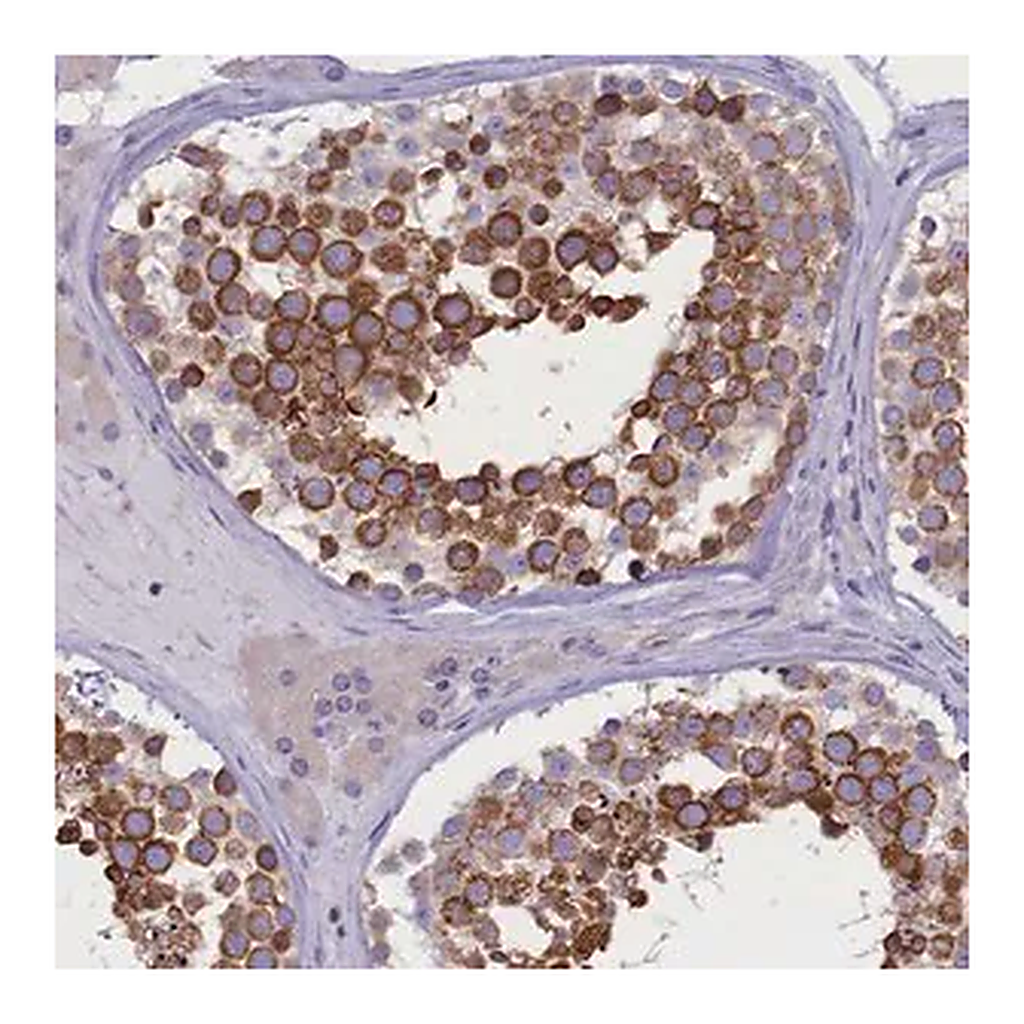 Merck Anti-DCAF16 antibody produced in rabbit