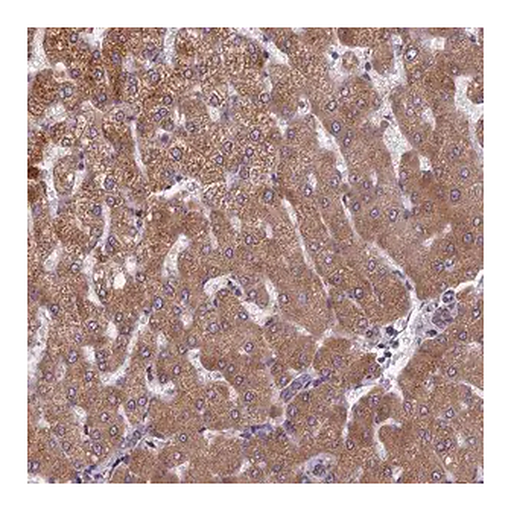 Merck Anti-FADS1 antibody produced in rabbit