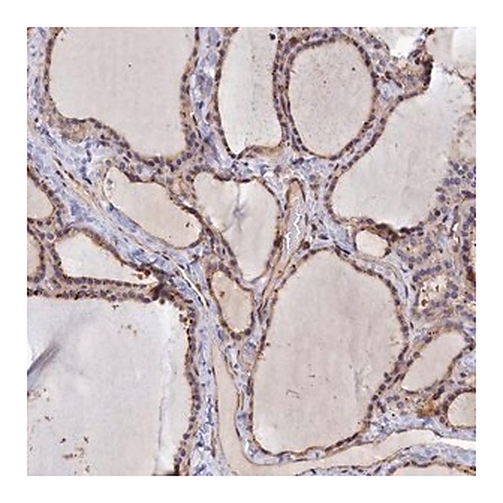 Merck Anti-ANKRD27 antibody produced in rabbit