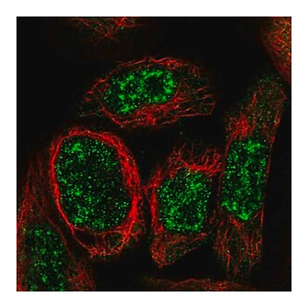 Merck Anti-WDR17 antibody produced in rabbit