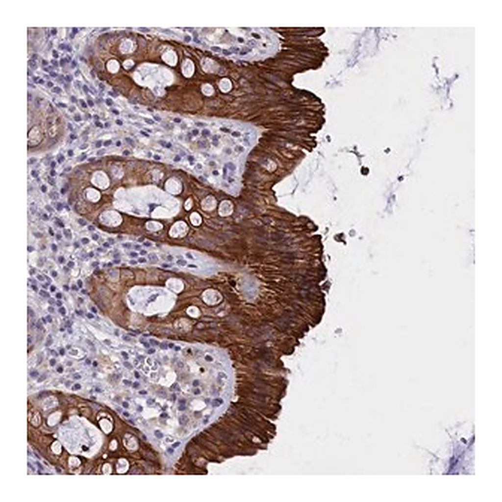Merck Anti-C16orf62 antibody produced in rabbit