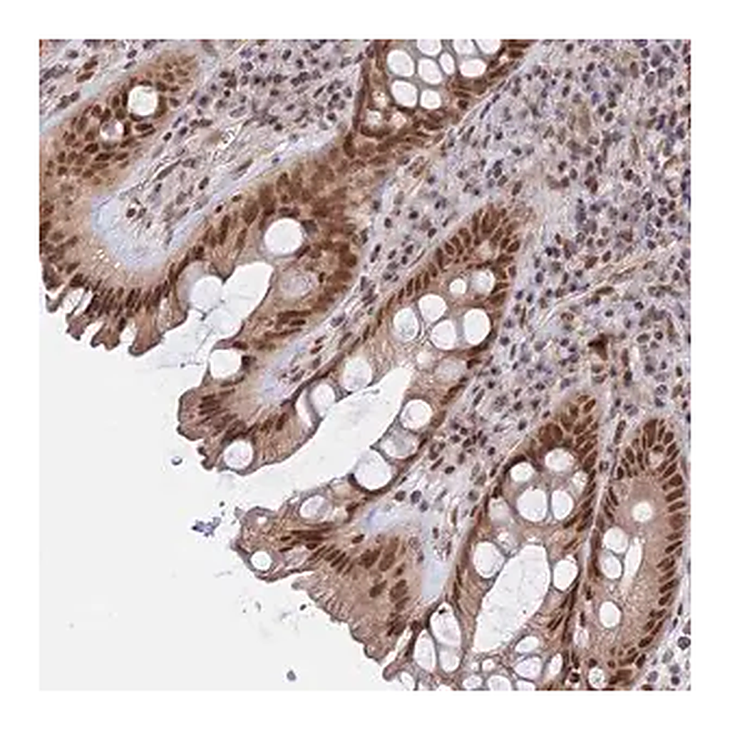 Merck Anti-CCDC85A antibody produced in rabbit