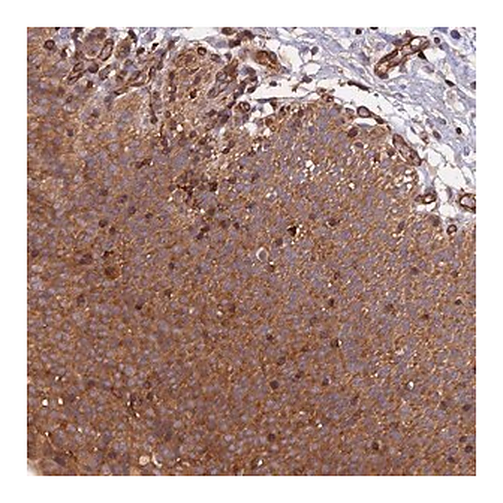 Merck Anti-C5orf22 antibody produced in rabbit