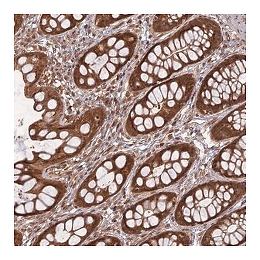 Merck Anti-ANAPC4 antibody produced in rabbit