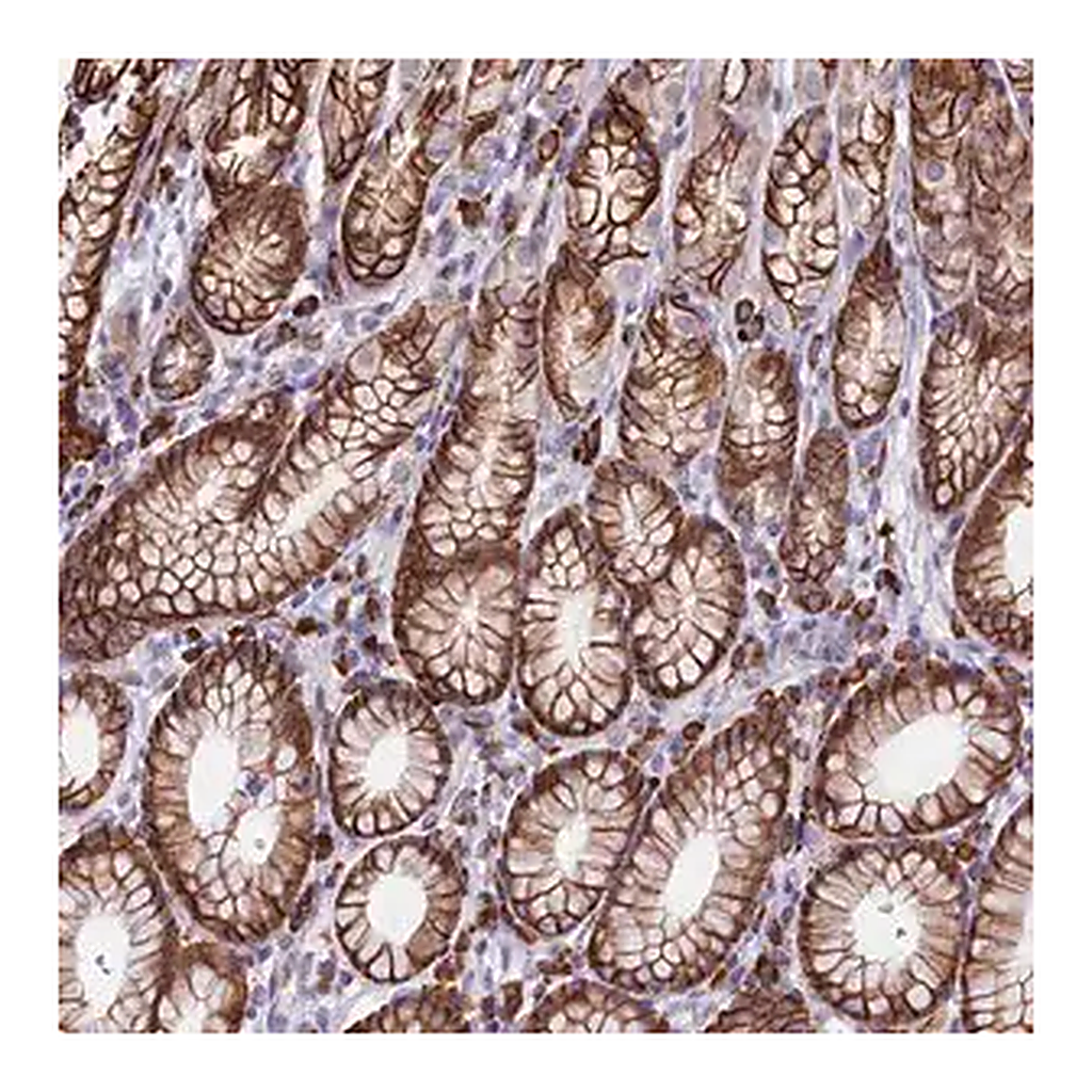 Merck Anti-C5orf15 antibody produced in rabbit