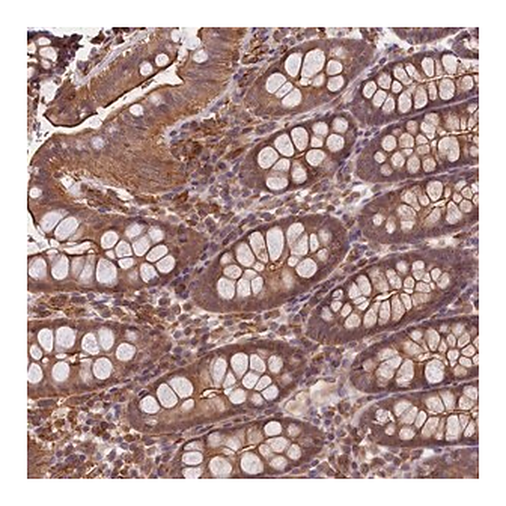 Merck Anti-SKIDA1 antibody produced in rabbit