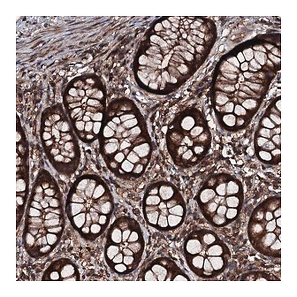 Merck Anti-KIF18A antibody produced in rabbit