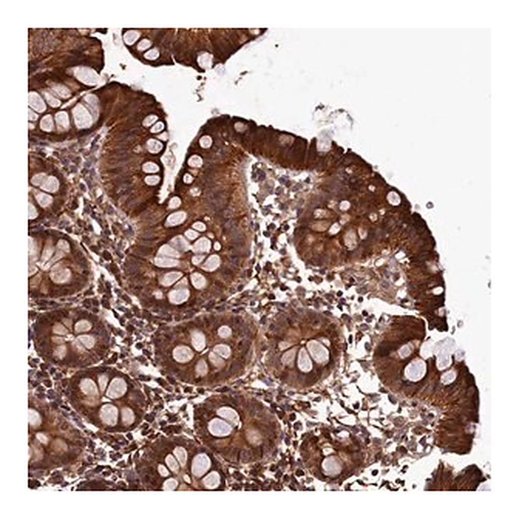 Merck Anti-LCMT2 antibody produced in rabbit