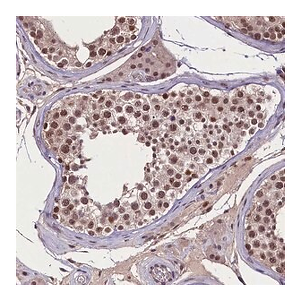 Merck Anti-RNMT antibody produced in rabbit