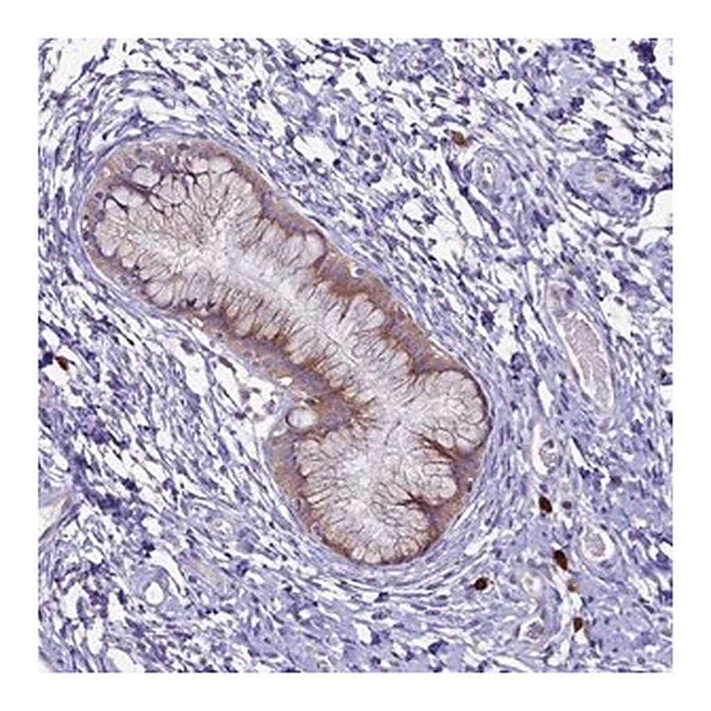 Merck Anti-METTL25 antibody produced in rabbit