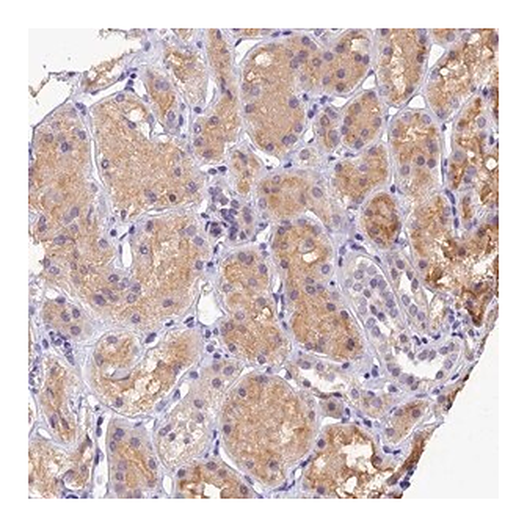 Merck Anti-DGKH antibody produced in rabbit