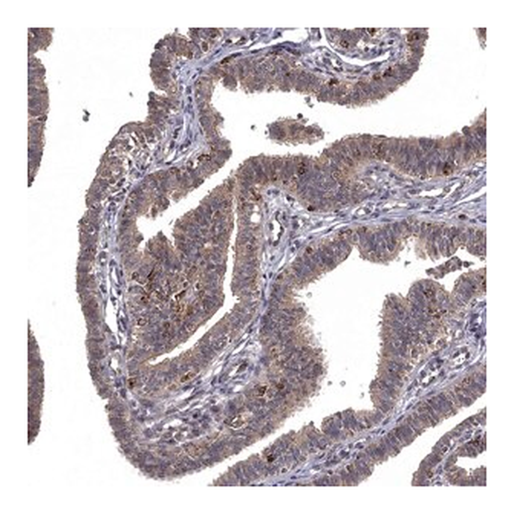 Merck Anti-WDR19 antibody produced in rabbit