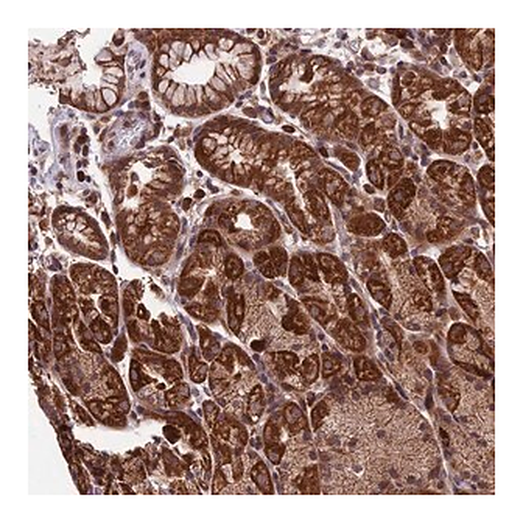 Merck Anti-RNF17 antibody produced in rabbit