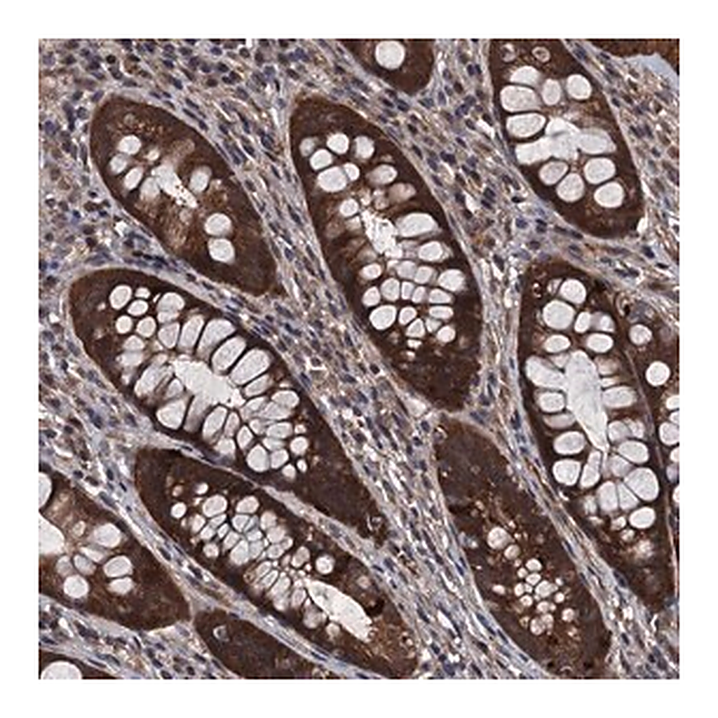 Merck Anti-UHRF1BP1L antibody produced in rabbit