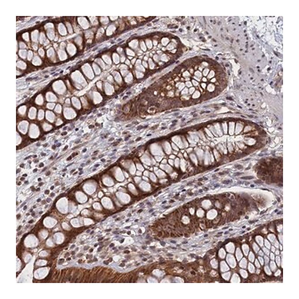 Merck Anti-PIGQ antibody produced in rabbit