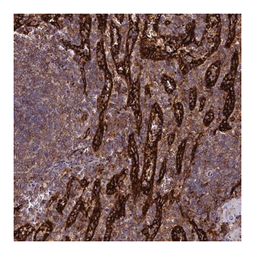 Merck Anti-PLEKHO2 antibody produced in rabbit