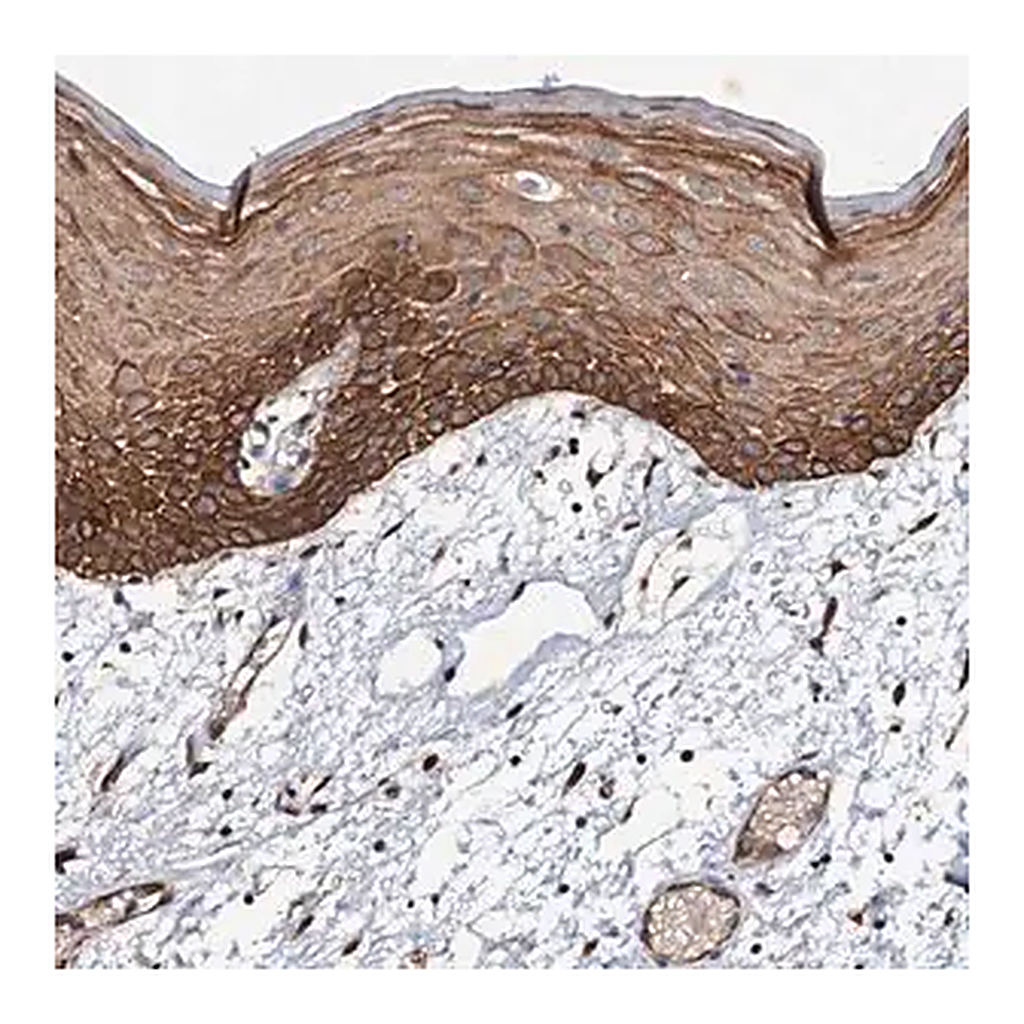 Merck Anti-ADAMTS10 antibody produced in rabbit