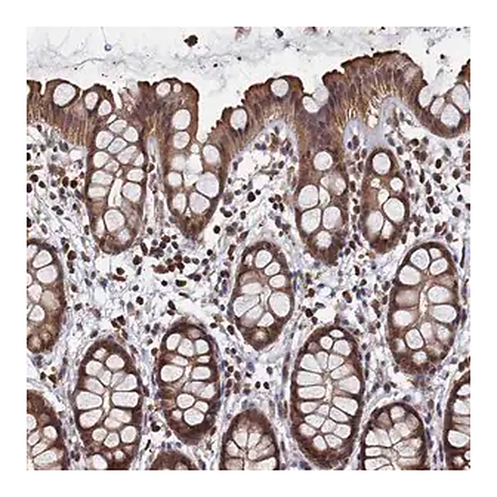 Merck Anti-PIGN antibody produced in rabbit