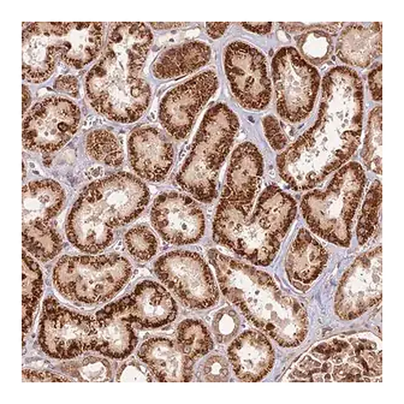 Merck Anti-DGKH antibody produced in rabbit