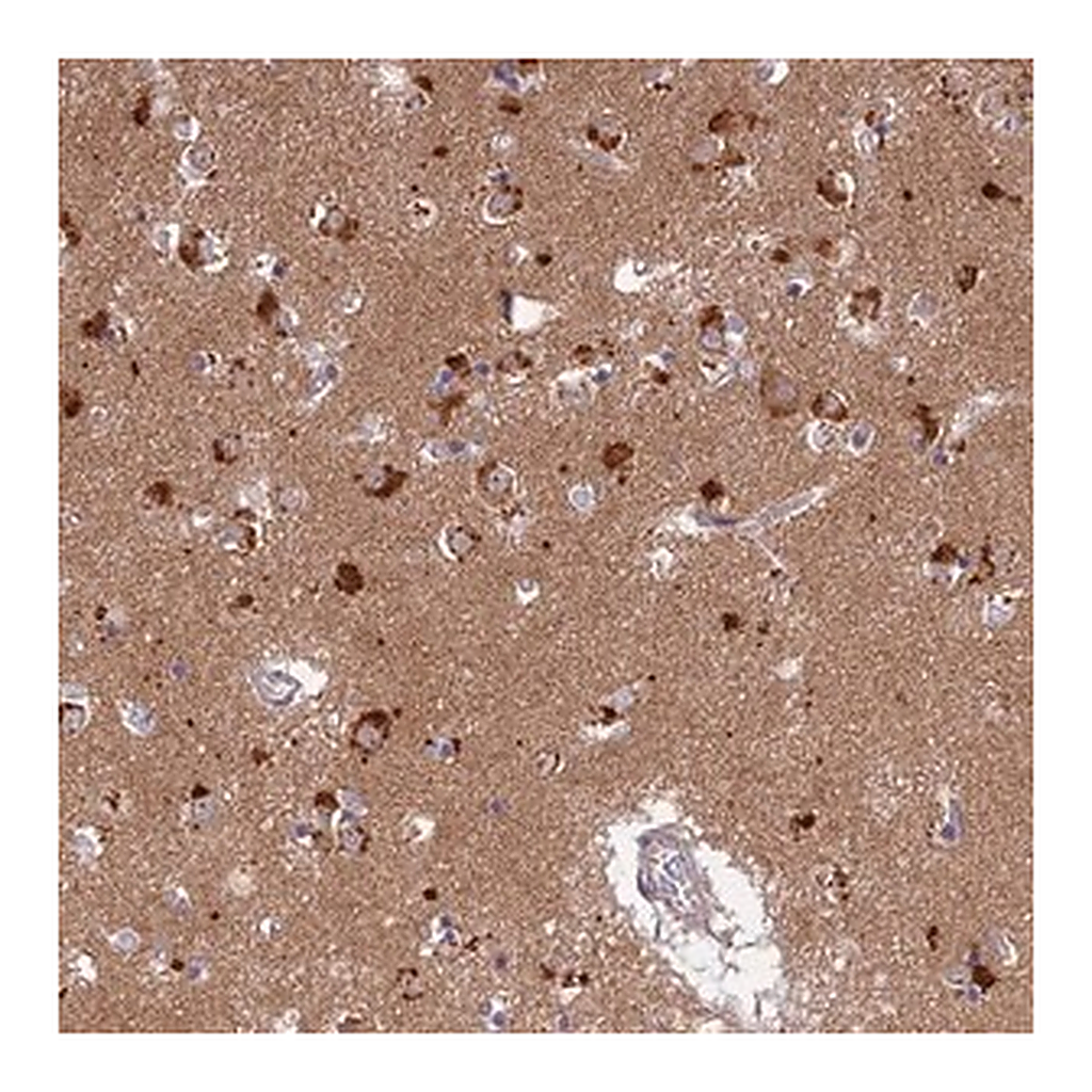 Merck Anti-LYSMD2 antibody produced in rabbit