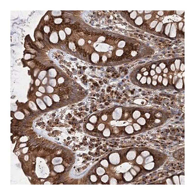 Merck Anti-ANKRD26 antibody produced in rabbit