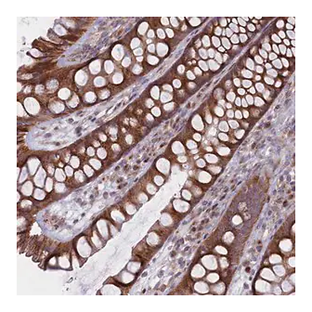 Merck Anti-MTFMT antibody produced in rabbit