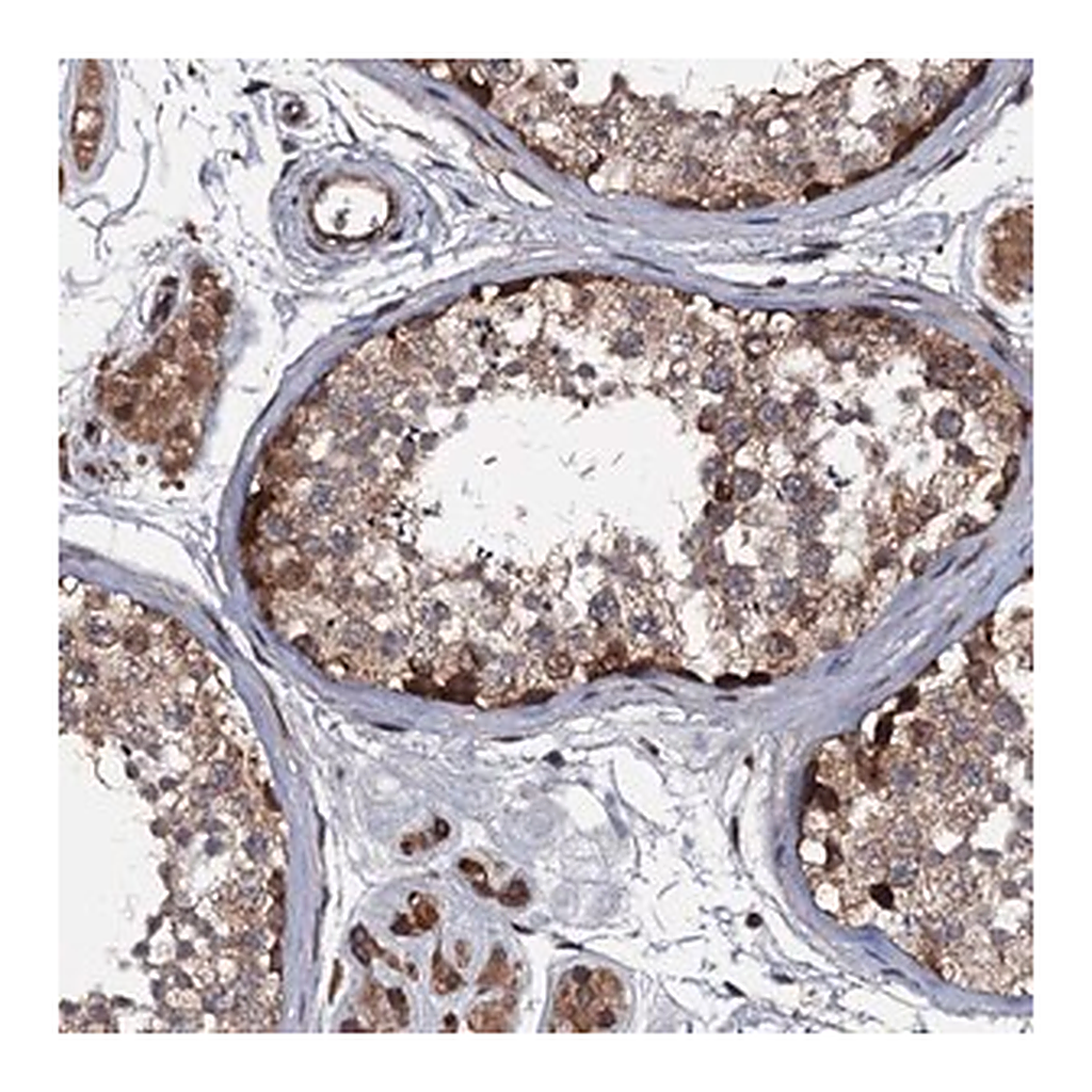Merck Anti-N4BP1 antibody produced in rabbit