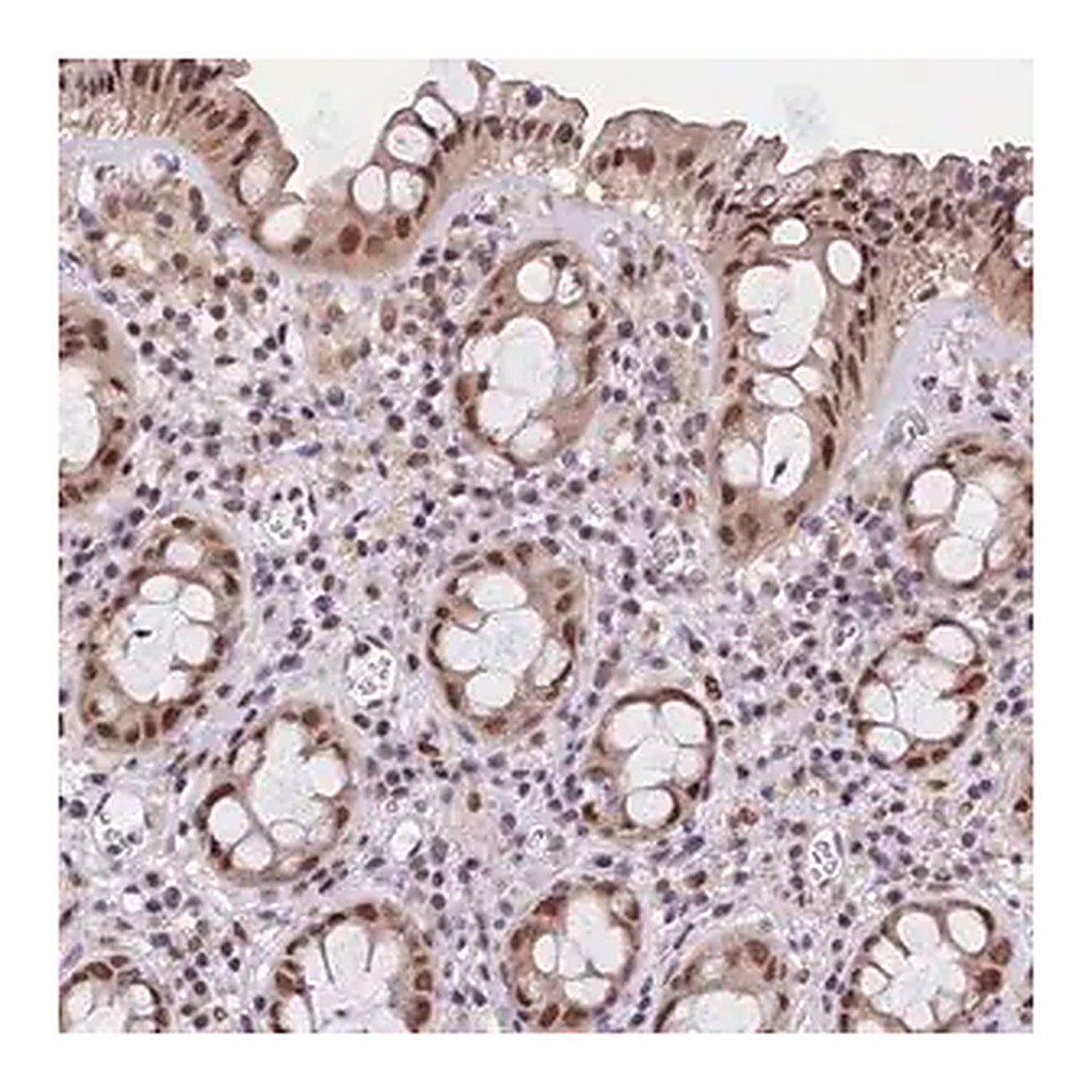 Merck Anti-CDYL2 antibody produced in rabbit