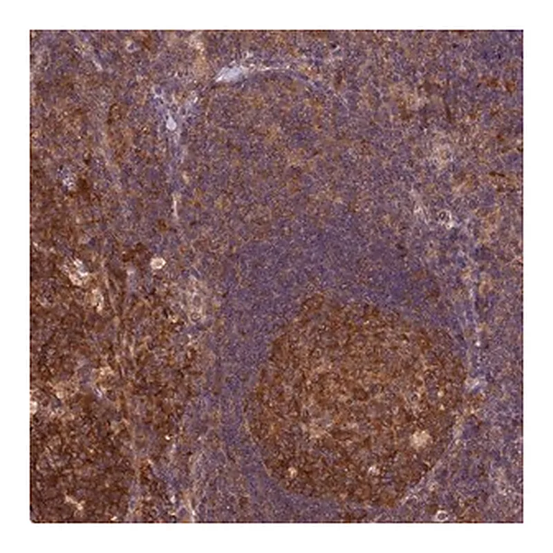 Merck Anti-TRMT1 antibody produced in rabbit