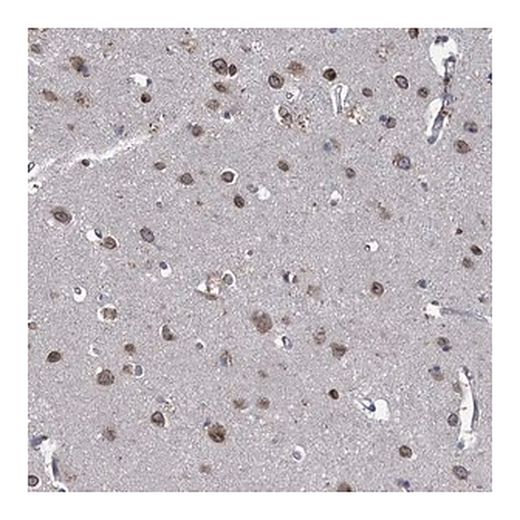 Merck Anti-CTU2 antibody produced in rabbit