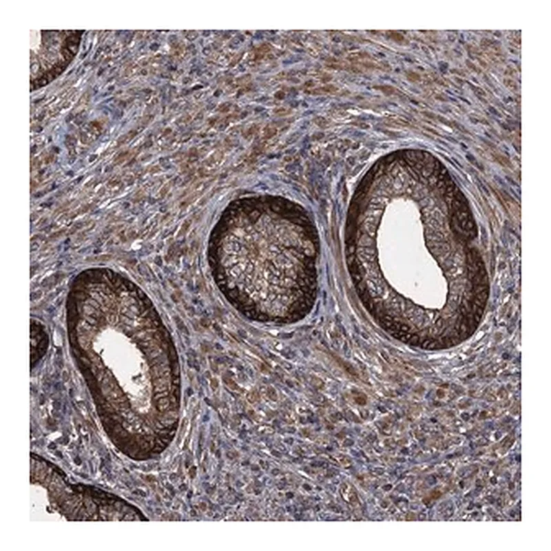 Merck Anti-TXNDC11 antibody produced in rabbit
