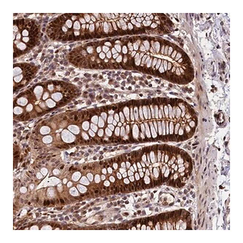 Merck Anti-C16orf70 antibody produced in rabbit