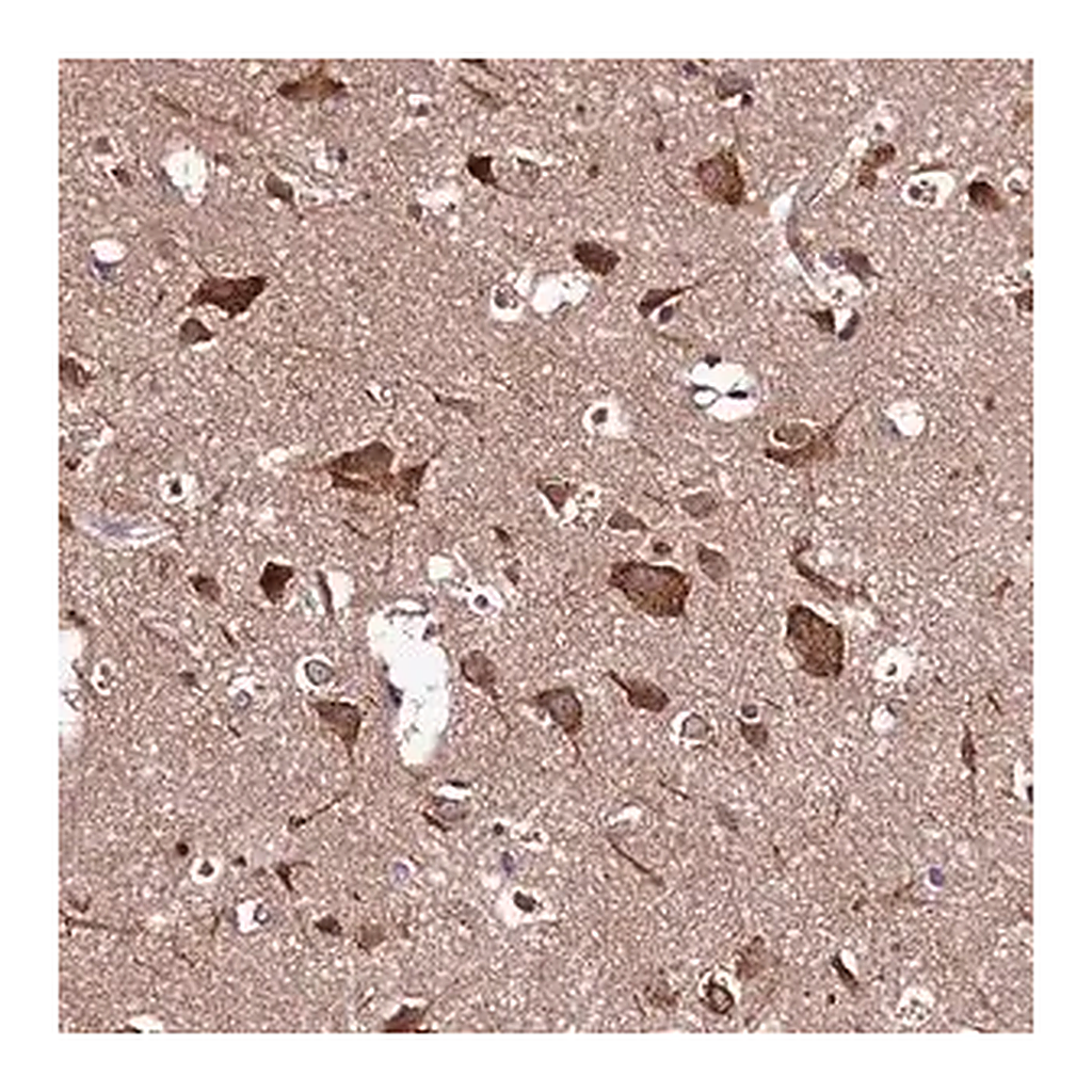 Merck Anti-HYLS1 antibody produced in rabbit