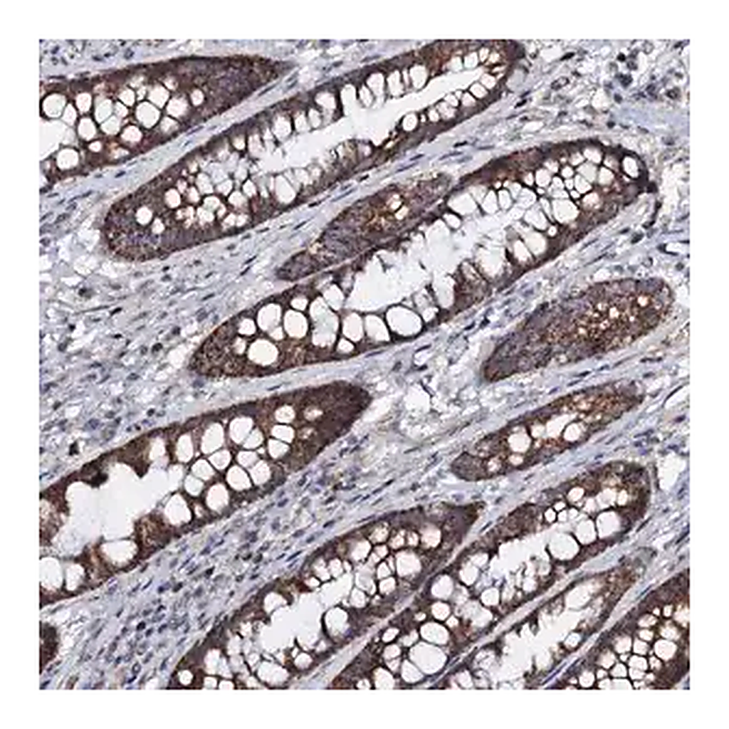 Merck Anti-PPP1R3D antibody produced in rabbit