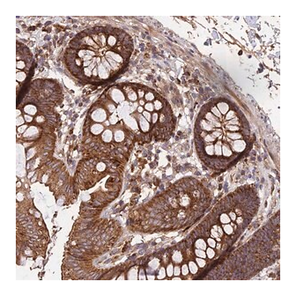 Merck Anti-NUDT8 antibody produced in rabbit
